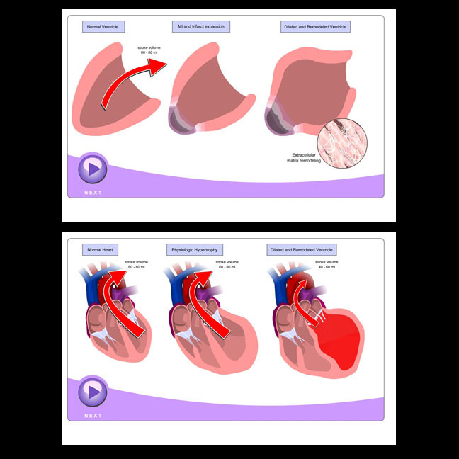 physiology of heart. It explains heart physiology